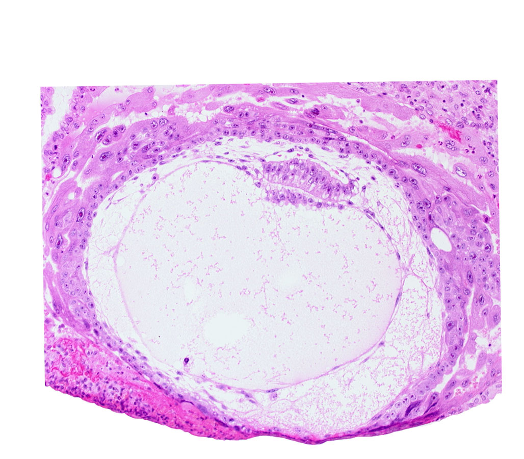 amnion, amniotic cavity, chorion, chorionic cavity, condensed extra-embryonic mesoblasts, definitive exocoelomic (Heuser's) membrane, extra-embryonic mesoblast, extra-embryonic reticulum, hypoblast, lacunar vascular circle, primary umbilical vesicle cavity, uterine cavity