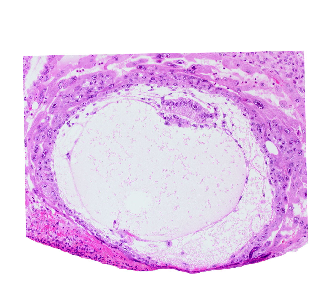 chorionic cavity, extra-embryonic mesoblast, lacunar vascular circle, primary umbilical vesicle cavity, uterine cavity