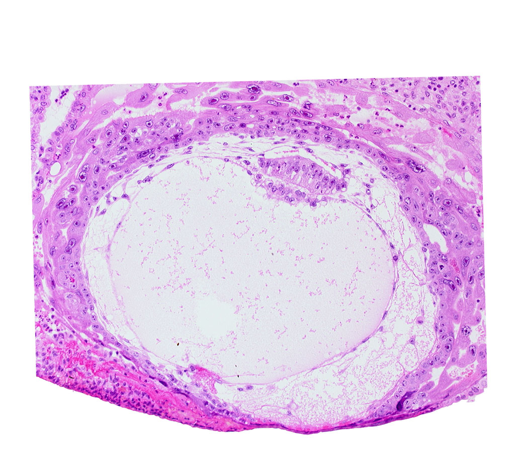 amniotic cavity, chorionic cavity, extra-embryonic reticulum, primary umbilical vesicle cavity, uterine cavity