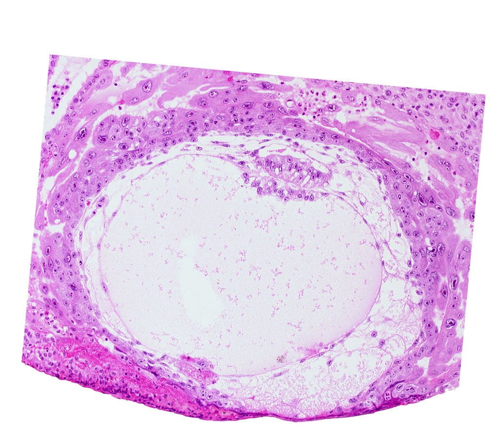 chorionic cavity, epiblast vacuole, fibrous coagulum, primary umbilical vesicle cavity, uterine cavity