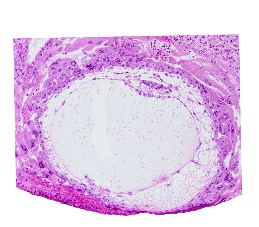 exocoelomic (Heuser's) membrane, extra-embryonic mesoblast, fibrous coagulum, primary umbilical vesicle cavity, uterine cavity