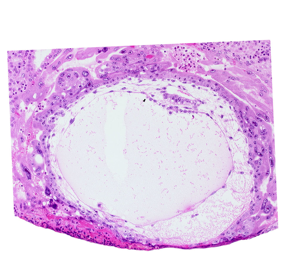 chorionic cavity, embryonic disc, epiblast vacuole, extra-embryonic mesoblast, primary umbilical vesicle cavity