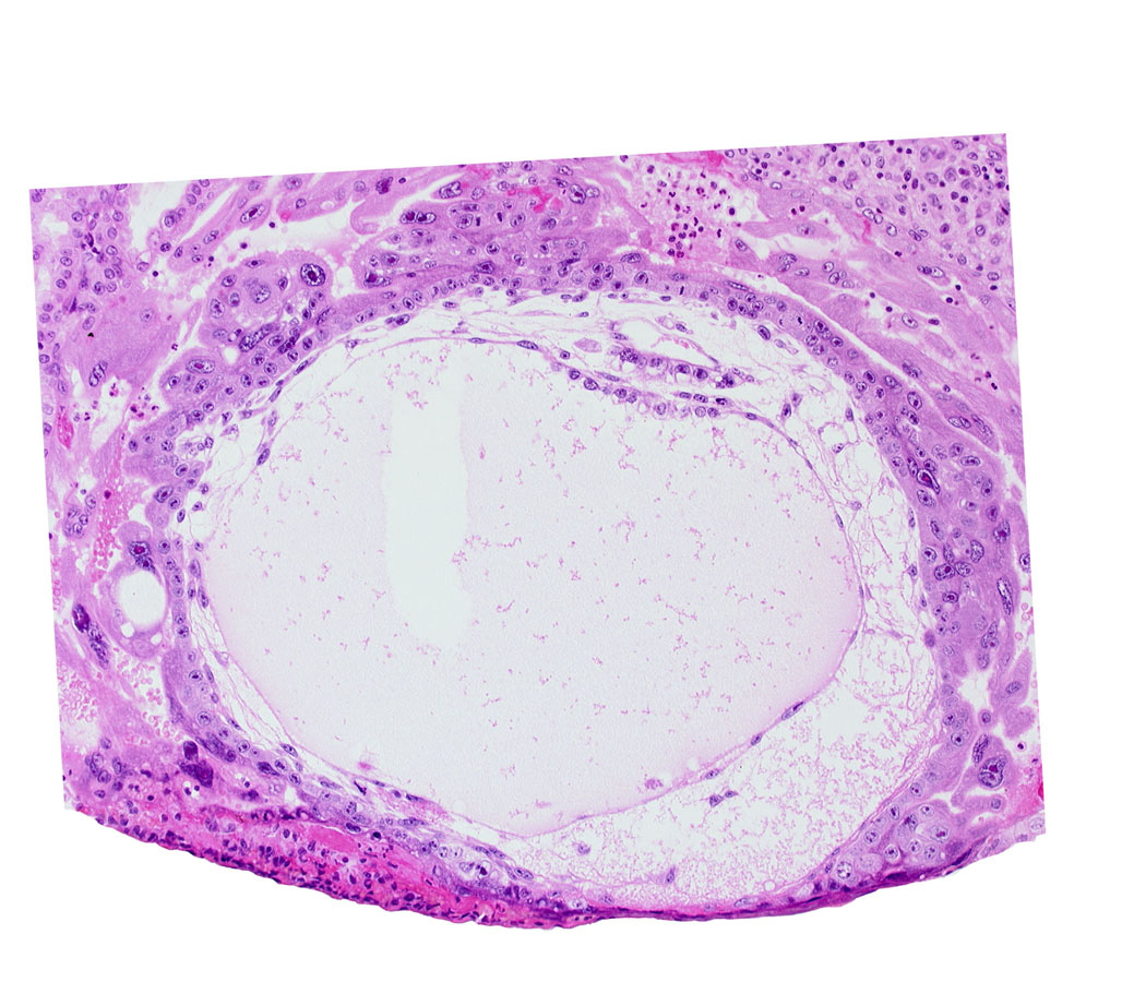 chorionic cavity, extra-embryonic mesoblast, lacunar vascular circle, primary umbilical vesicle cavity