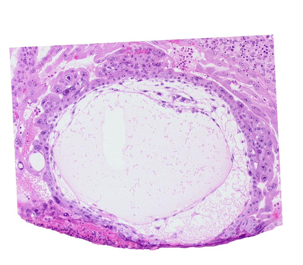 angioblastic tissue of mesoblast, chorion, chorionic cavity, cytotrophoblast, edge of amniotic cavity, epiblast, exocoelomic (Heuser's) membrane, extra-embryonic endoblast, extra-embryonic mesoblast, hypoblast, lacunar vascular circle, primary umbilical vesicle cavity, syncytiotrophoblast