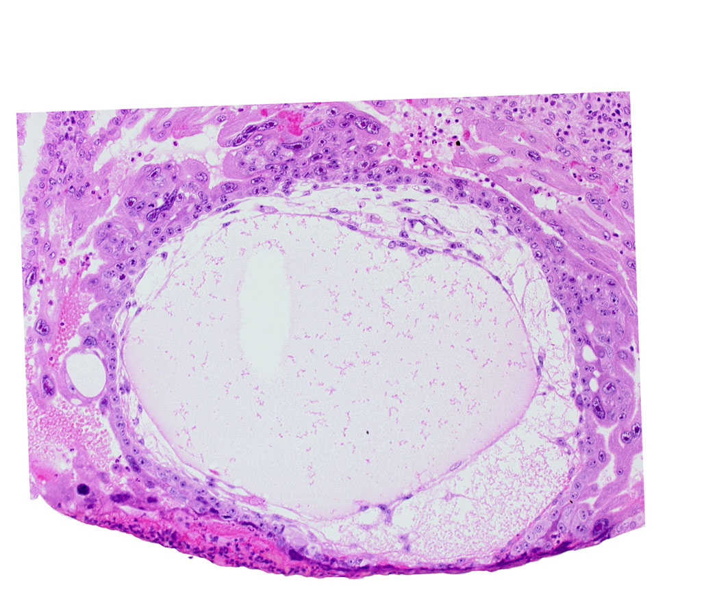 angioblastic tissue of mesoblast, chorionic cavity, edge of embryonic disc, primary umbilical vesicle cavity