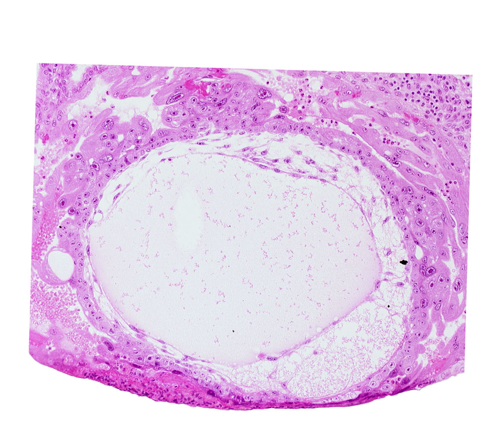 chorionic cavity, exocoelomic (Heuser's) membrane, primary umbilical vesicle cavity