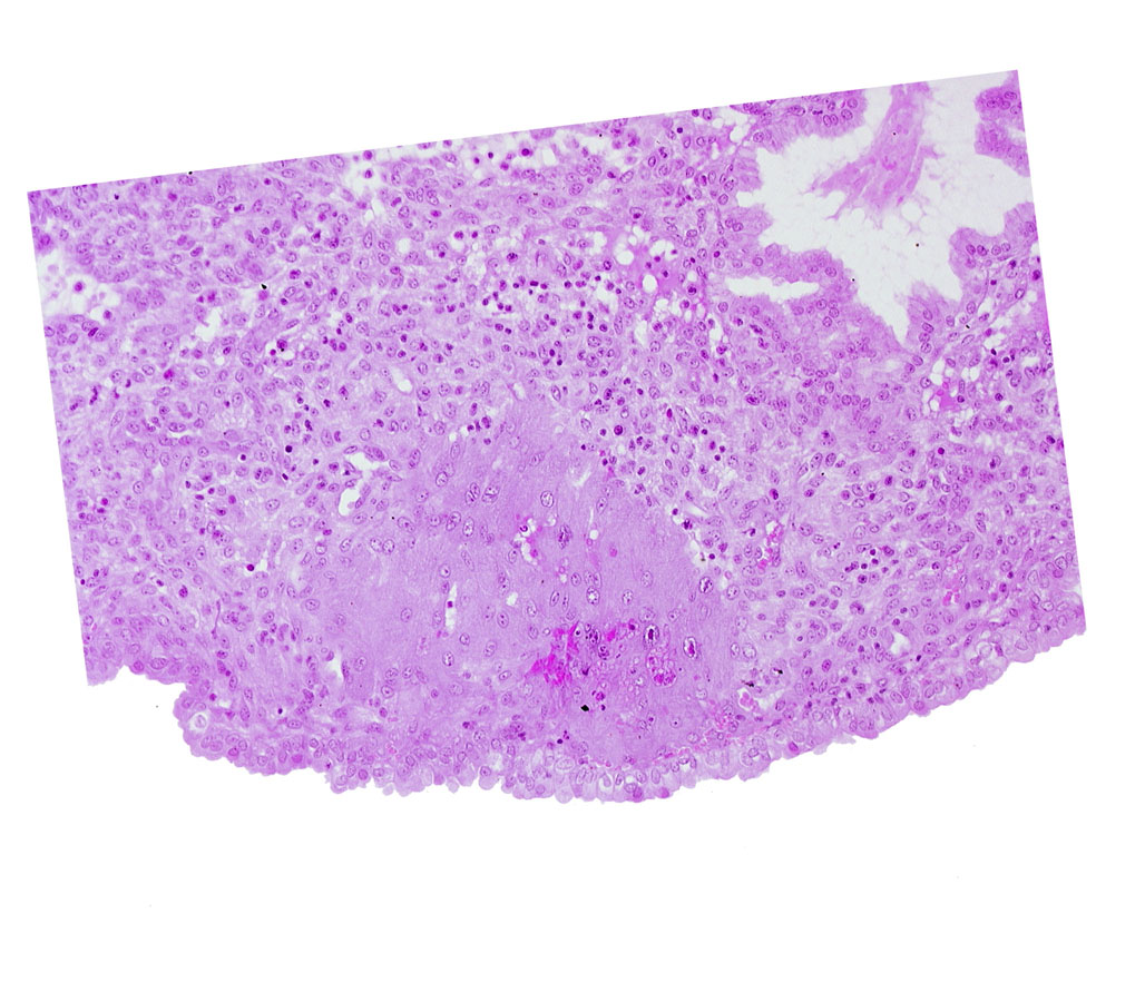 endometrial epithelium, lumen of endometrial gland, syncytiotrophoblast, uterine cavity