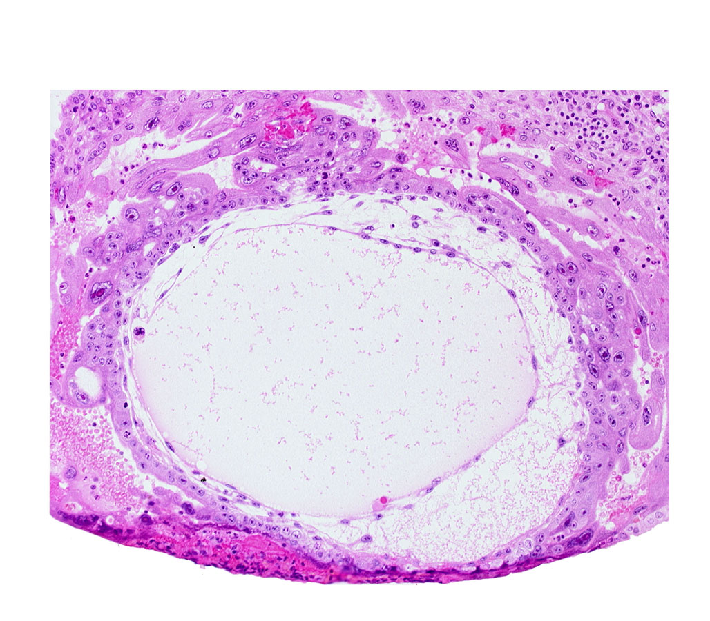 chorionic cavity, cytotrophoblast, primary umbilical vesicle cavity, syncytiotrophoblast, uterine cavity