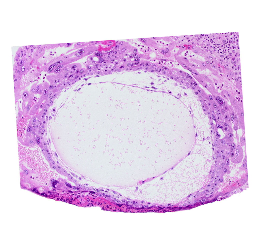 chorionic cavity, lacunar vascular circle, primary umbilical vesicle cavity, uterine cavity