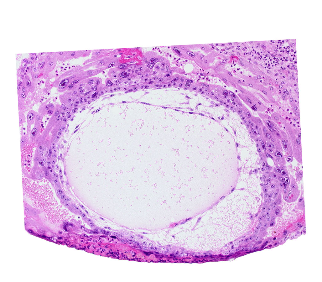 chorionic cavity, cytotrophoblast, lacunar vascular circle, primary umbilical vesicle cavity, syncytiotrophoblast