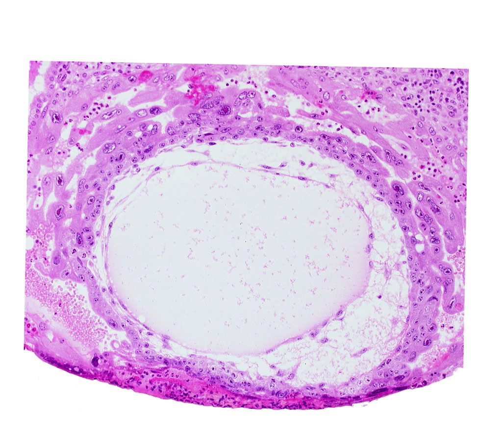 angioblastic tissue, chorionic cavity, cytotrophoblast, definitive exocoelomic (Heuser's) membrane, fibrous coagulum, lacunar vascular circle, previllus crest of mesoblast, previllus mesoblast clump, primary umbilical vesicle cavity, syncytiotrophoblast, uterine cavity