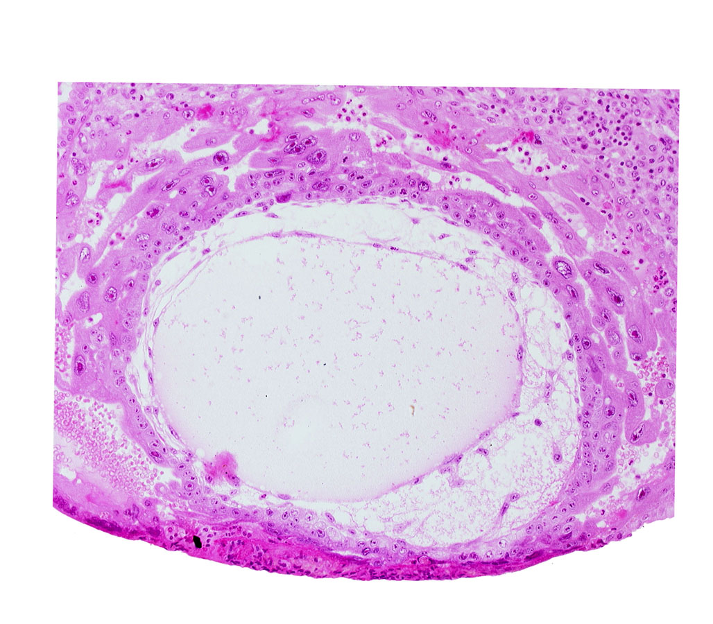 angioblastic tissue, definitive exocoelomic (Heuser's) membrane, fibrous coagulum, lacunar vascular circle, uterine cavity