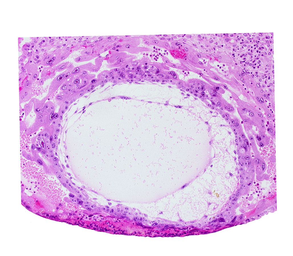 chorionic cavity, lacunar vascular circle, primary umbilical vesicle cavity, syncytiotrophoblast, uterine cavity