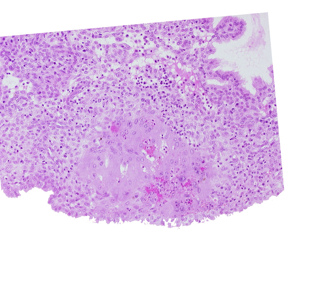 endometrial epithelium, lumen of endometrial gland, syncytiotrophoblast, uterine cavity