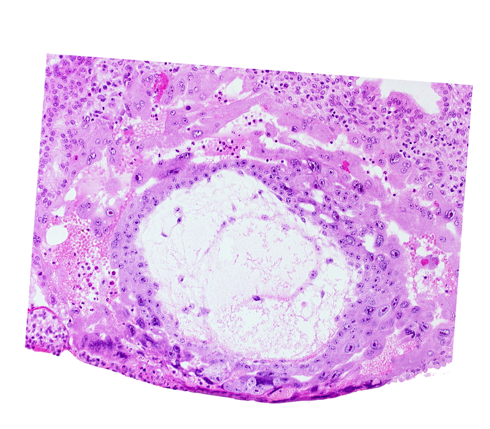 chorionic cavity, extra-embryonic reticulum, lacunar vascular circle