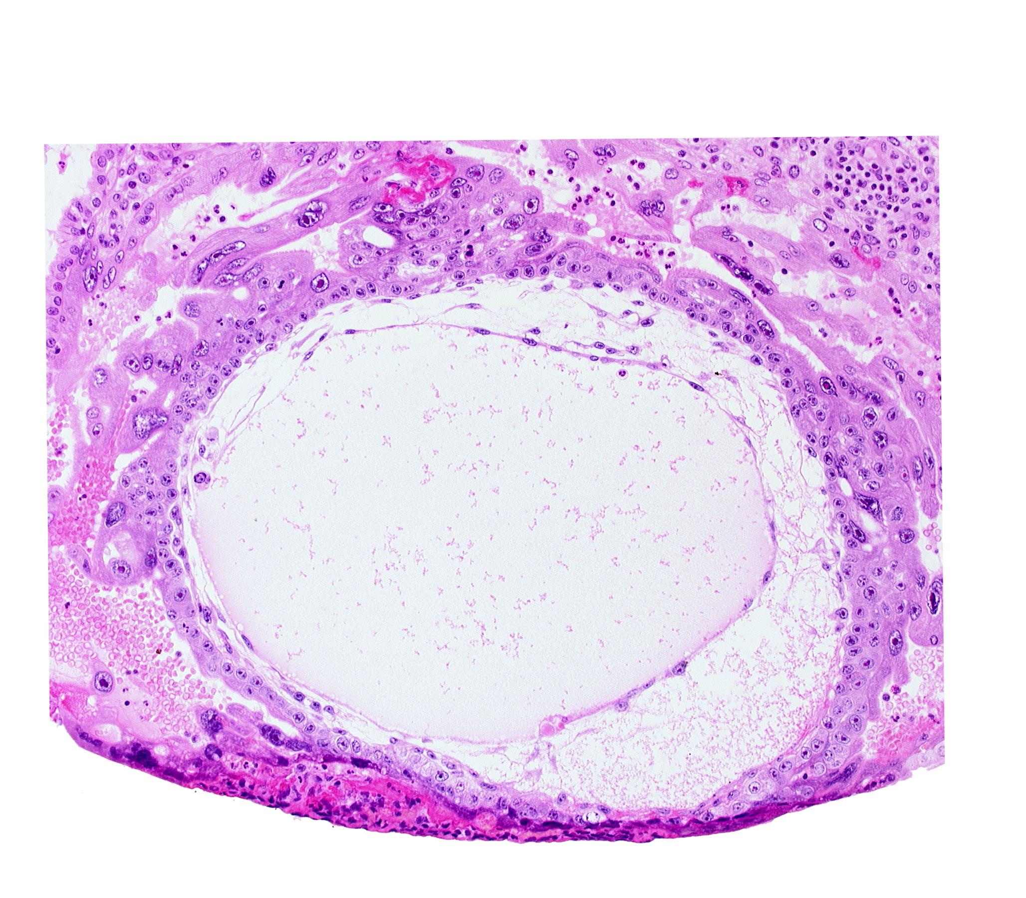chorionic cavity, cytotrophoblast, primary umbilical vesicle cavity, syncytiotrophoblast, uterine cavity