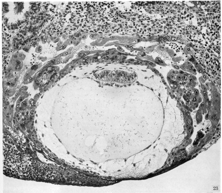 High-power view of midsagittal section