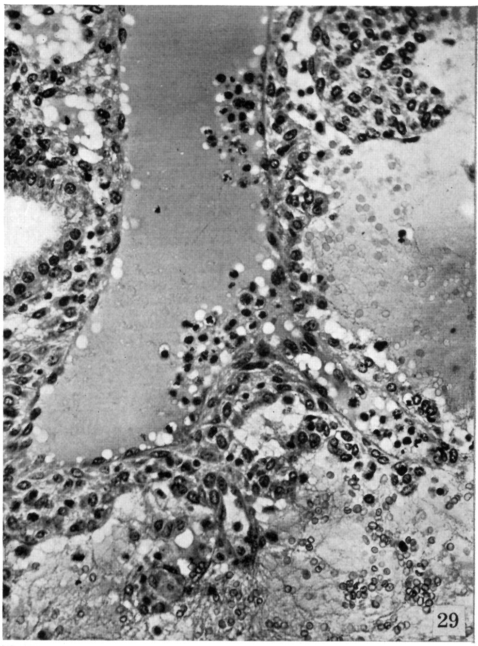 Detail of arteriovenous sinusoid