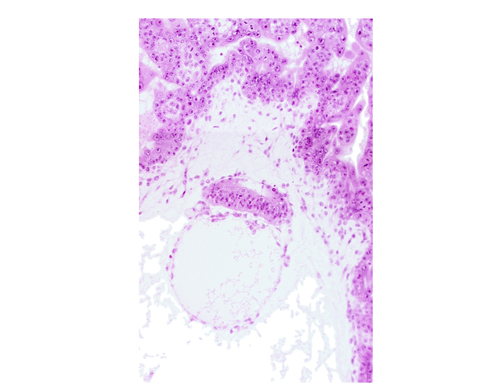 epiblast, extra-embryonic coelom, hypoblast, secondary umbilical vesicle cavity