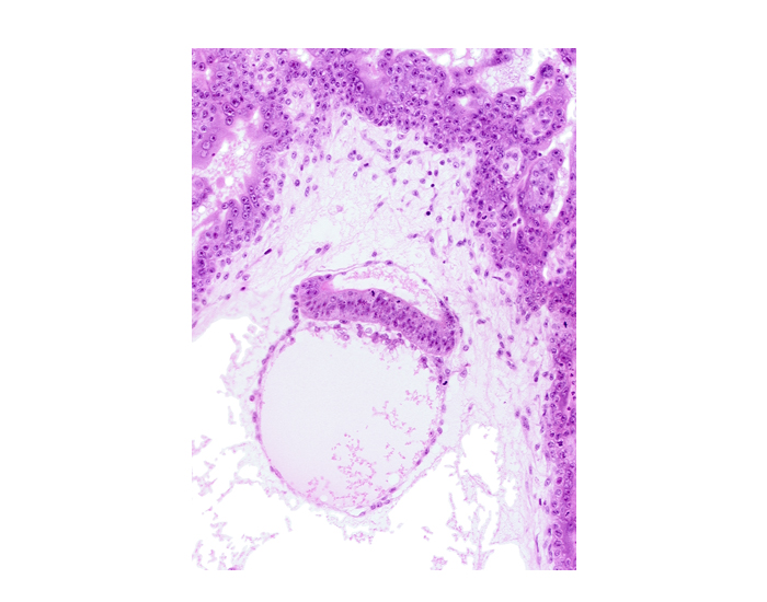 amniotic cavity, epiblast, head mesenchyme, hypoblast, one-layered surface epithelium, secondary umbilical vesicle cavity