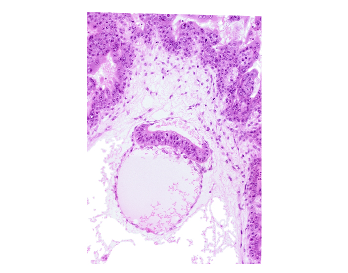 amnion, embryonic disc, extra-embryonic coelom, head mesenchyme