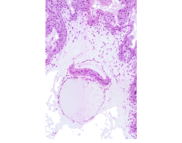 chorion, extra-embryonic coelom, head mesenchyme, hypoblast, intervillus space(s)