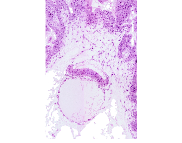 epiblast, extra-embryonic endoderm, head mesenchyme, hypoblast, mesoblast (mesenchyme), primordial blood vessel(s), tertiary villus