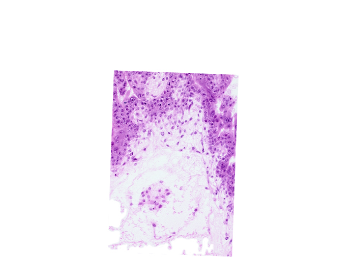 cephalic edge of secondary umbilical vesicle wall, chorion, extra-embryonic coelom (exocoelom), intervillus space(s), mesoblast (mesenchyme), trophoblast