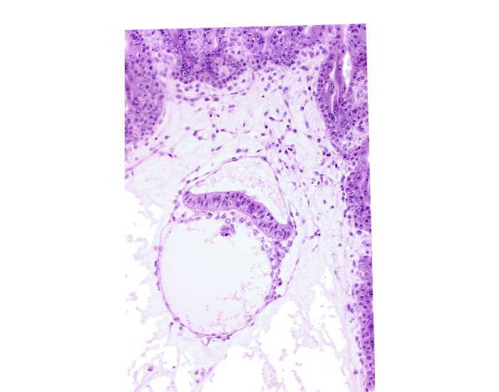 amniotic cavity, intervillus space(s), junction of extra-embryonic endoderm and hypoblast, secondary umbilical vesicle cavity