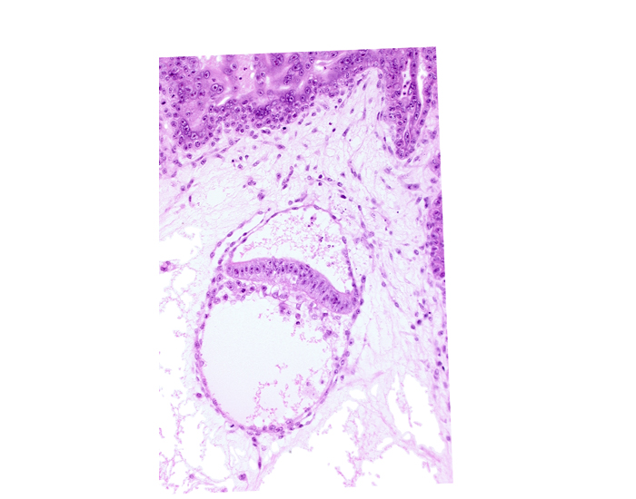 amniotic cavity, epiblast, head mesenchyme, hypoblast, junction of amnion and epiblast, secondary umbilical vesicle process, two-layered amnion