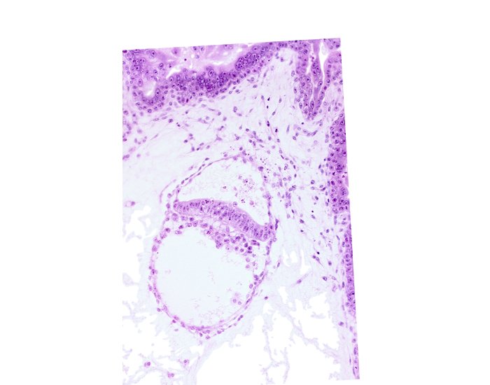 amniotic cavity, extra-embryonic coelom, extra-embryonic endoderm, head mesenchyme, secondary umbilical vesicle cavity