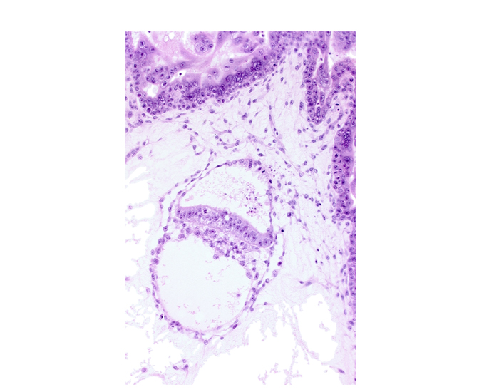 amniotic cavity, epiblast, hypoblast, presumptive prechordal plate, primordial blood vessel(s), secondary umbilical vesicle cavity