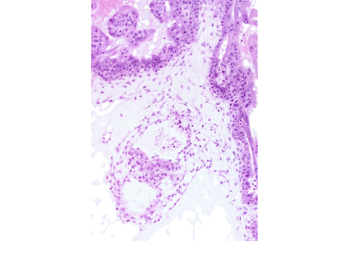 amniotic cavity, caudal end of primordial gastrulation (primitive) streak, extra-embryonic mesoderm (mesenchyme), intervillus space(s), primary villus, primordial connecting stalk, stem villus