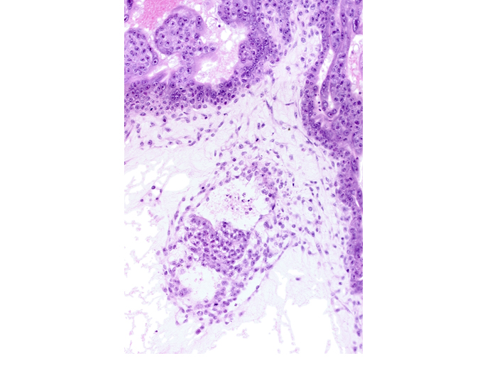 amniotic cavity, caudal edge of presumptive amniotic duct, caudal end of primordial gastrulation (primitive) groove, caudal end of primordial gastrulation (primitive) streak, caudal part of secondary umbilical vesicle cavity, epiblast, mesoderm, presumptive cloacal membrane, primordial germ cell(s)