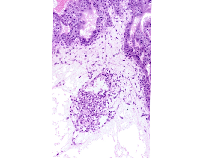 caudal part of amniotic cavity, caudal part of epiblast, endodermal mass, secondary umbilical vesicle process, specialized cells in amnion