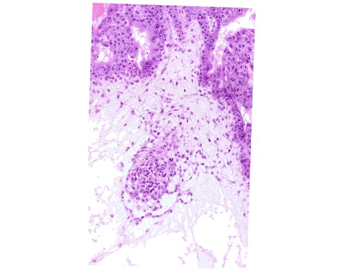 caudal edge of specialized cells in amnion, cytotrophoblast, endodermal mass, intervillus space(s), primordial connecting stalk, primordial germ cell(s), syncytiotrophoblast