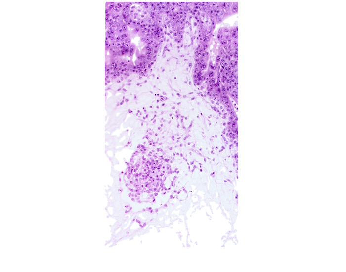 extra-embryonic coelom, primordial blood vessel(s), stem villus, syncytiotrophoblast