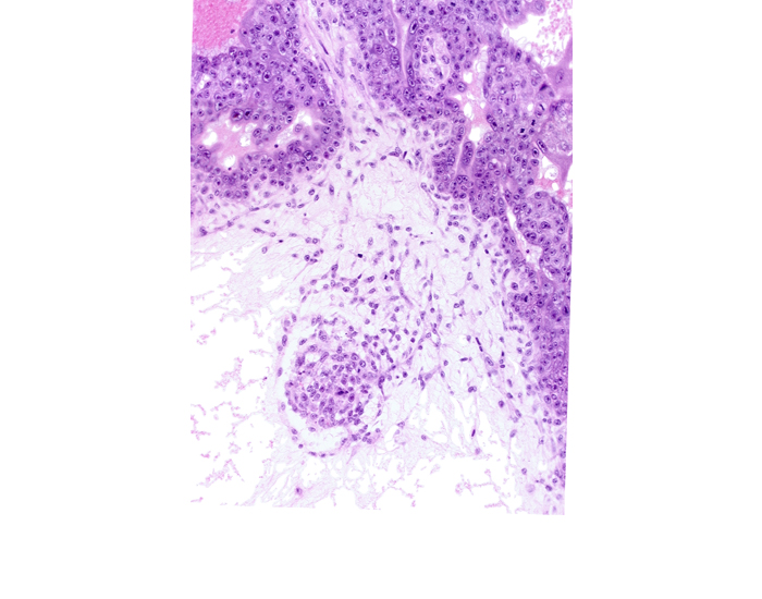 endodermal mass, extra-embryonic mesoblast, hemangioblastic tissue, primordial connecting stalk mesenchyme, stem villus