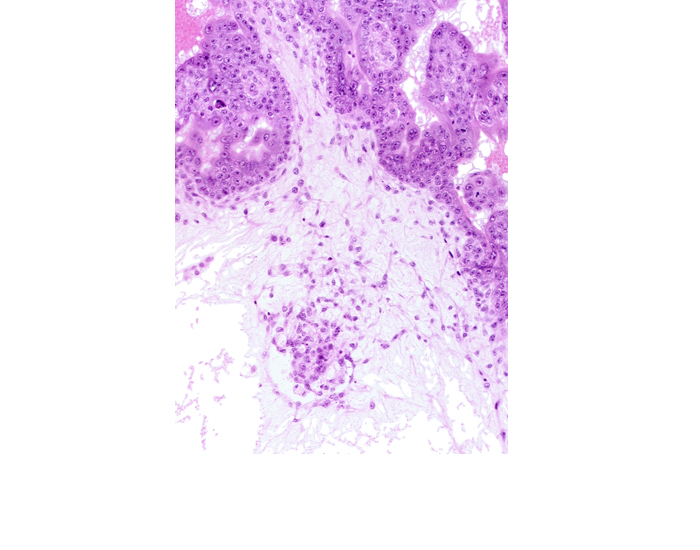 caudal part of endodermal mass, extra-embryonic coelom, extra-embryonic mesoblast, hemangioblastic tissue, mesoblast (mesenchyme) core of secondary stem villus, primordial germ cell(s)