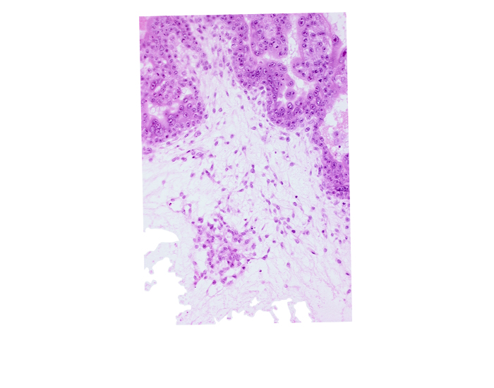 caudal edge of endodermal mass, cytotrophoblast, extra-embryonic coelom, intervillus space(s), syncytiotrophoblast