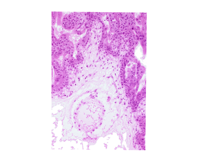 cephalic part of secondary umbilical vesicle wall, extra-embryonic coelom (exocoelom), intervillus space(s), secondary umbilical vesicle wall, trophoblast