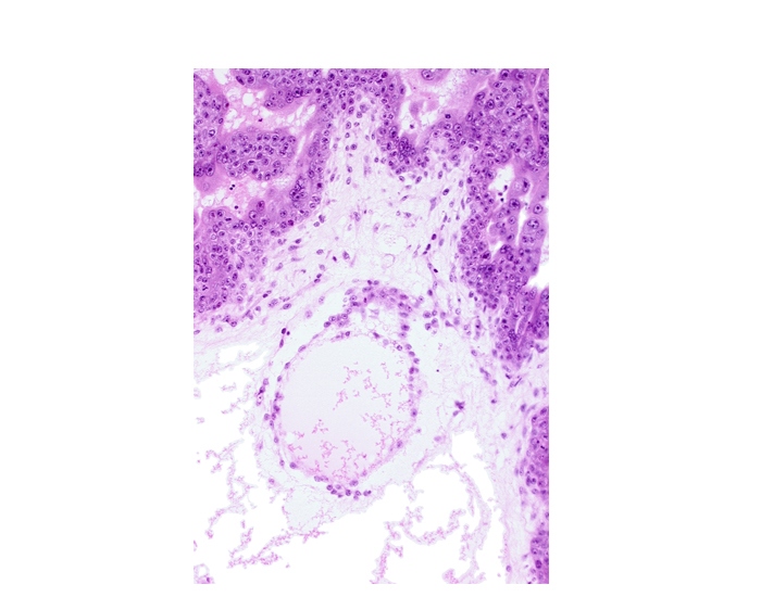 extra-embryonic coelom, extra-embryonic splanchnopleuric mesoderm, stem villus