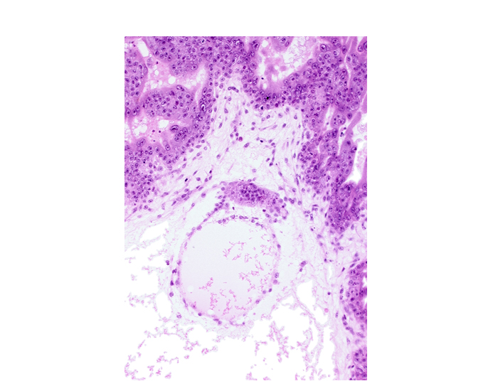 cephalic part of embryonic disc, cytotrophoblast, extra-embryonic coelom, mesoblast (mesenchyme)