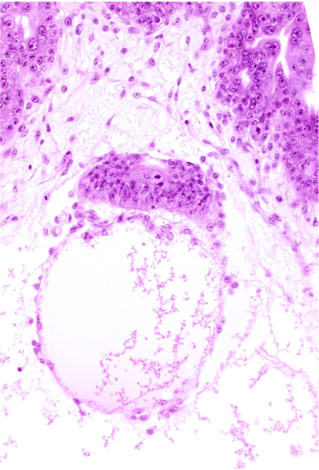 cephalic edge of amnion, cephalic edge of amniotic cavity, embryonic disc, epiblast, hypoblast, secondary umbilical vesicle cavity