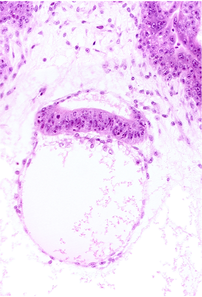 embryonic disc, epiblast, extra-embryonic coelom, head mesenchyme, hypoblast, secondary umbilical vesicle cavity