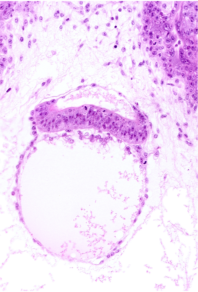 amniotic cavity, epiblast, head mesenchyme, hypoblast, one-layered surface epithelium, secondary umbilical vesicle cavity