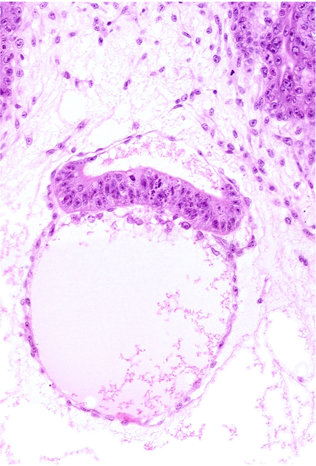 amnion, embryonic disc, extra-embryonic coelom, head mesenchyme