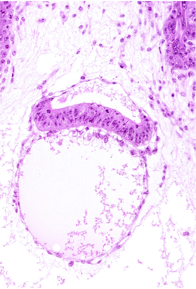 chorionic mesothelium, chorionic villi, epiblast, hypoblast, intervillus space(s), primordial connecting stalk