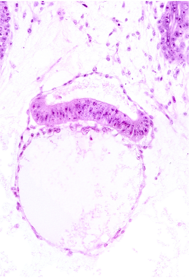 chorion, extra-embryonic coelom, head mesenchyme, hypoblast, intervillus space(s)