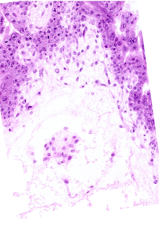 cephalic edge of secondary umbilical vesicle wall, chorion, extra-embryonic coelom (exocoelom), intervillus space(s), mesoblast (mesenchyme), trophoblast